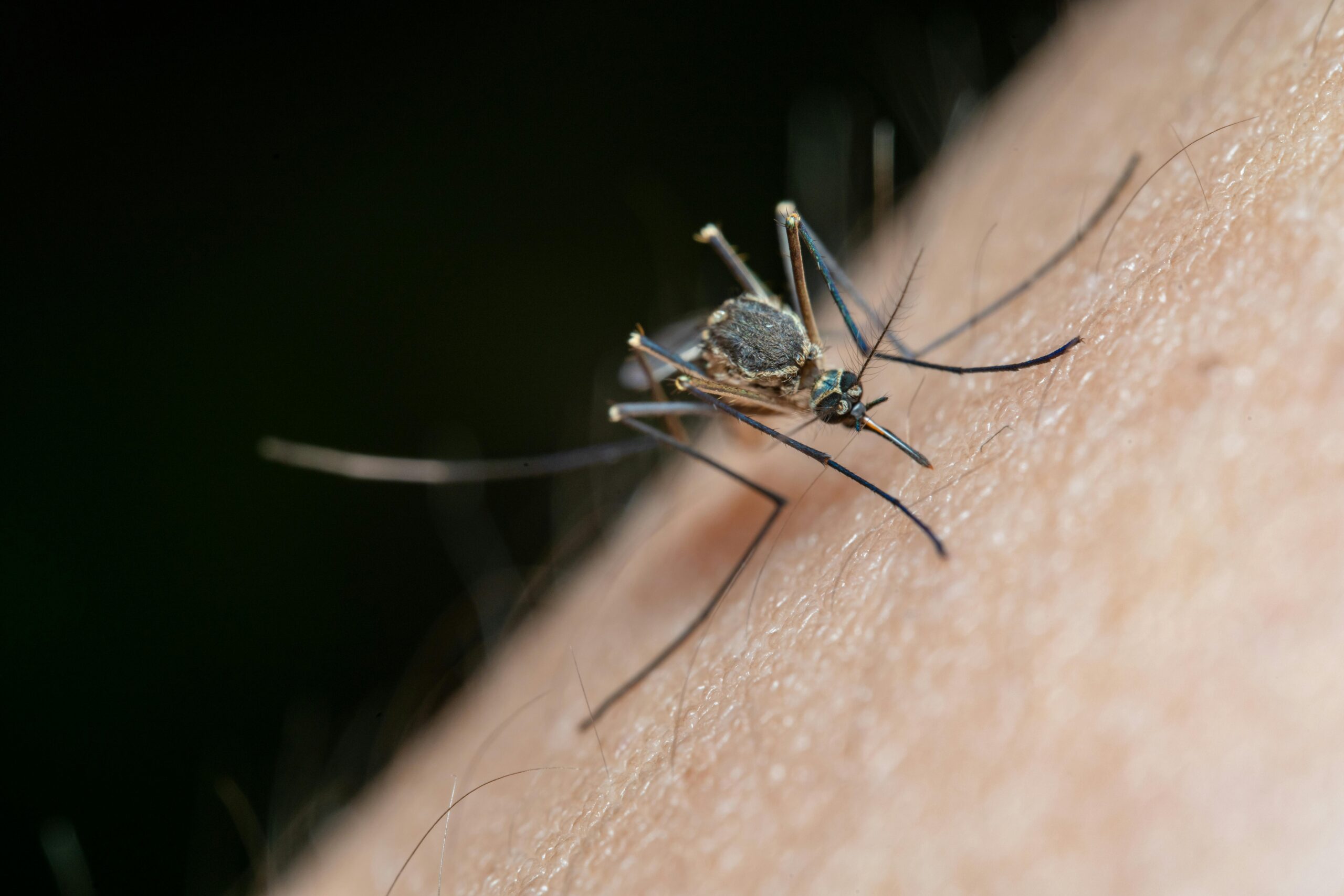 Celebridades que alivian las picaduras de insectos: todos somos iguales